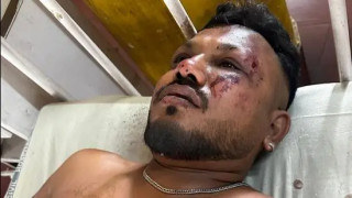 एयर इण्डियाको विमान दुर्घटना : एक बेलायती नागरिकको जीवितै उद्धार