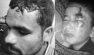 घरभित्र पसेको निहुँमा दलित बालकसहित आफन्तमाथि निर्घात कुटपिट